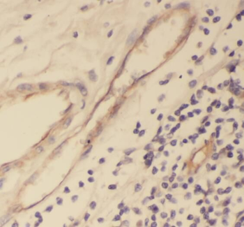 TPP1 Antibody