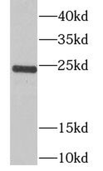 TPPP Rabbit Polyclonal Antibody