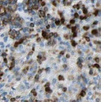 TPPP Rabbit Polyclonal Antibody