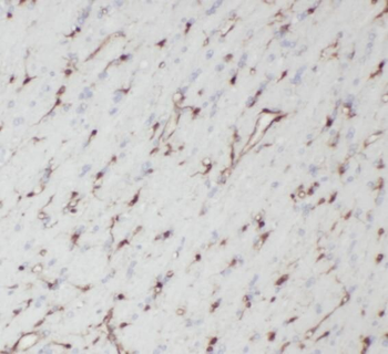 TPPP Rabbit Polyclonal Antibody