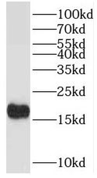 TPPP2 Antibody