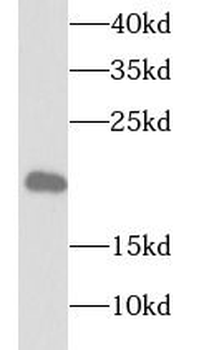 TPPP3 Rabbit Polyclonal Antibody