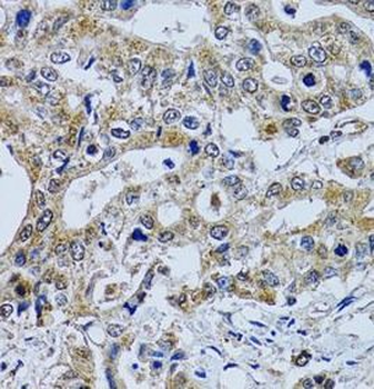 TPPP3 Rabbit Polyclonal Antibody