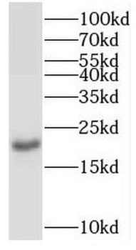 TPRKB Rabbit Polyclonal Antibody