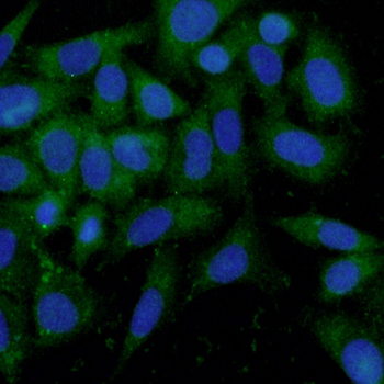 TPSAB1 Rabbit Polyclonal Antibody