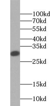TPSAB1 Mouse Monoclonal Antibody
