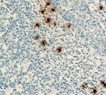 TPSAB1 Mouse Monoclonal Antibody