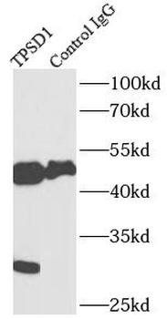 TPSD1 Rabbit Polyclonal Antibody