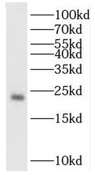TPT1 Rabbit Polyclonal Antibody