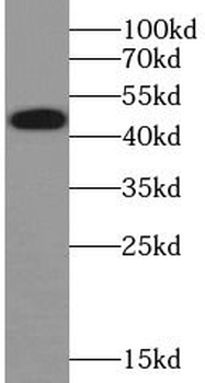 TRAIP Rabbit Polyclonal Antibody