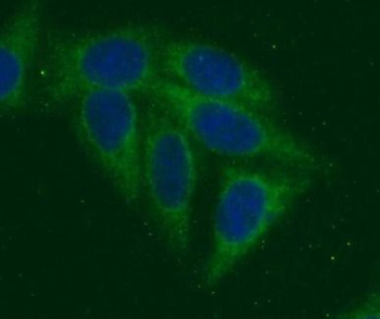TRAIP Rabbit Polyclonal Antibody