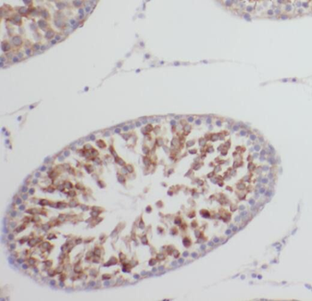 TRAIP Rabbit Polyclonal Antibody