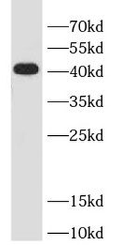 TARBP2 Rabbit Polyclonal Antibody