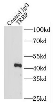TARBP2 Rabbit Polyclonal Antibody