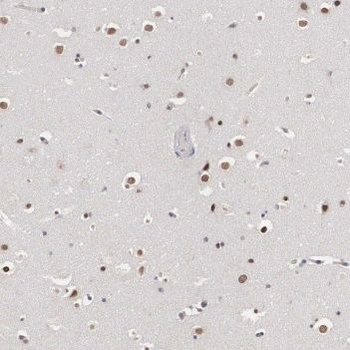 TARBP2 Rabbit Polyclonal Antibody