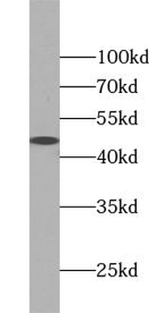 TRIB2 Rabbit Polyclonal Antibody