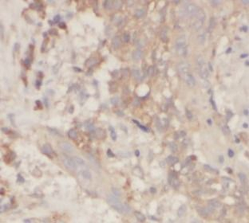 TRIM21 Rabbit Polyclonal Antibody