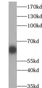 TRIM23 Rabbit Polyclonal Antibody