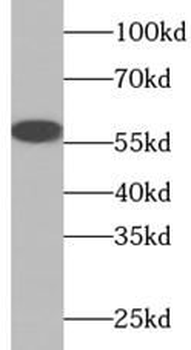 TRIM27 Rabbit Polyclonal Antibody