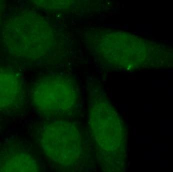 TRIM27 Rabbit Polyclonal Antibody