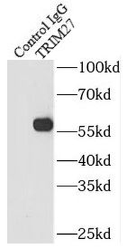 TRIM27 Rabbit Polyclonal Antibody