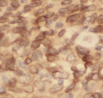 TRIM27 Rabbit Polyclonal Antibody