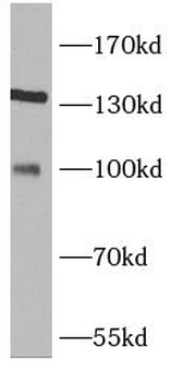 TRIM37 Antibody