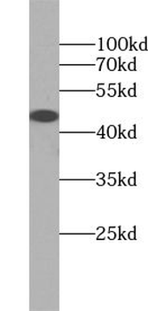 TRIM39 Rabbit Polyclonal Antibody
