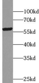 TRIM6 Rabbit Polyclonal Antibody