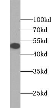 TRIP13 Rabbit Polyclonal Antibody