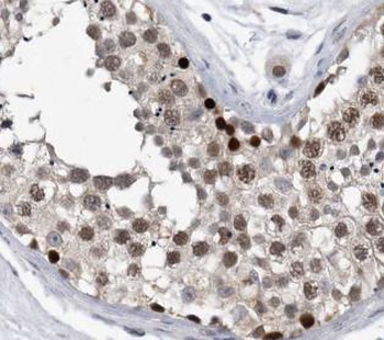 TRIP13 Rabbit Polyclonal Antibody