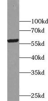 TFG Rabbit Polyclonal Antibody