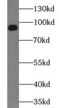 NTRK2 Rabbit Polyclonal Antibody