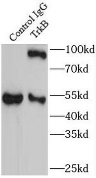NTRK2 Rabbit Polyclonal Antibody