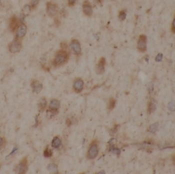 NTRK2 Rabbit Polyclonal Antibody