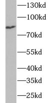 TRMT1 Rabbit Polyclonal Antibody