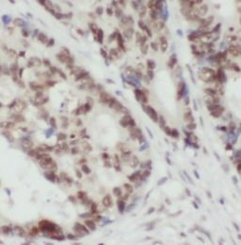 TRMT1 Rabbit Polyclonal Antibody