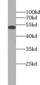 TRMT11 Rabbit Polyclonal Antibody