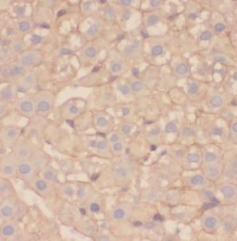 TRMT11 Rabbit Polyclonal Antibody