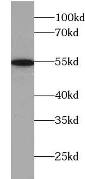 TRMT2B Rabbit Polyclonal Antibody