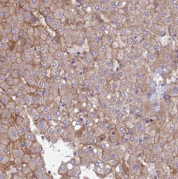 TRMT2B Rabbit Polyclonal Antibody