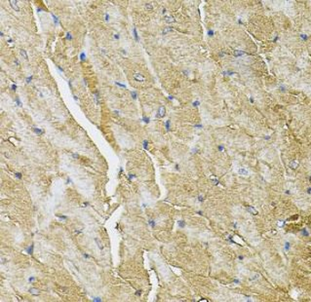 TRPC1 Rabbit Polyclonal Antibody