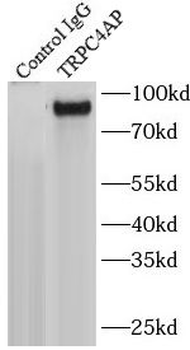 TRPC4AP Antibody