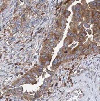 WARS1 Rabbit Polyclonal Antibody