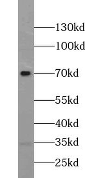 TRPV6 Rabbit Polyclonal Antibody