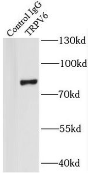 TRPV6 Rabbit Polyclonal Antibody