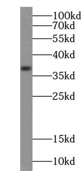 TRUB1 Rabbit Polyclonal Antibody