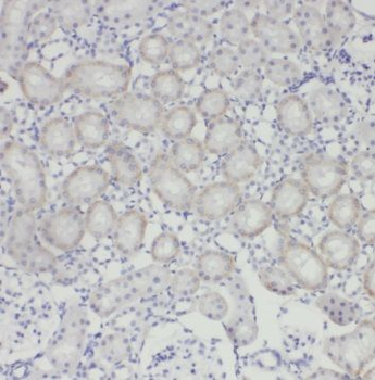 TRUB1 Rabbit Polyclonal Antibody