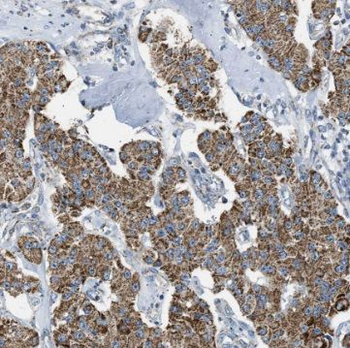 TSFM Rabbit Polyclonal Antibody