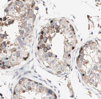 TSN Rabbit Polyclonal Antibody